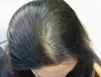   درمان ریزش مو با چند روش خانگی 