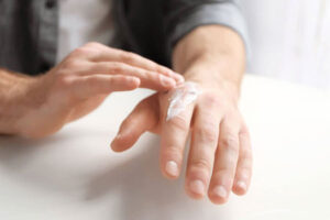 چگونه خشکی پوست دست را درمان کنیم؟
