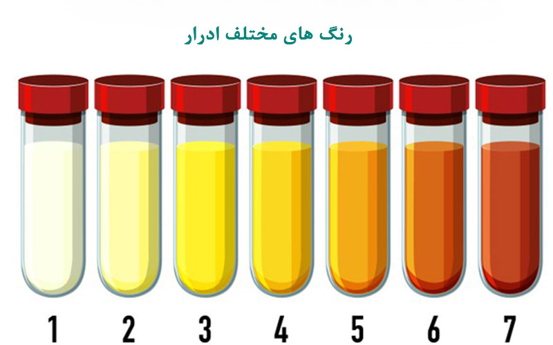 different-color-of-urine.jpg